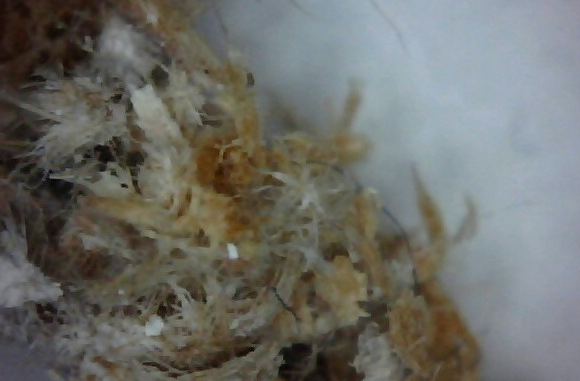 Morgellons The Silent Pandemic