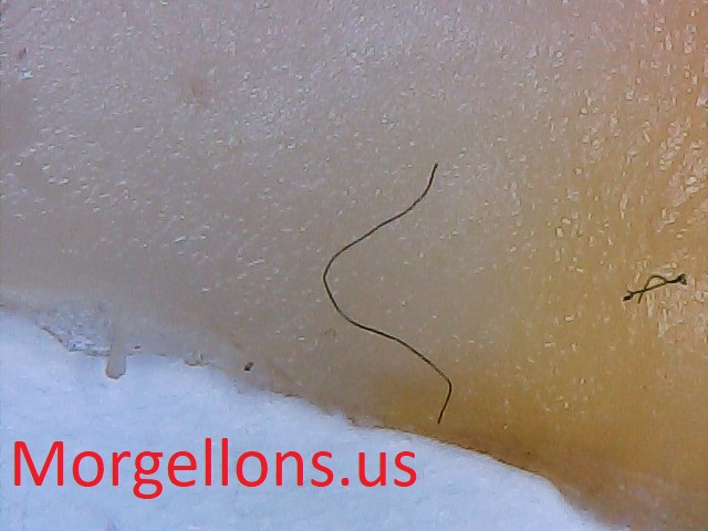 Aspergillus Fumigatus The silent Pandemic and Thailand Medical News on COVID 19 – Morgellons.us