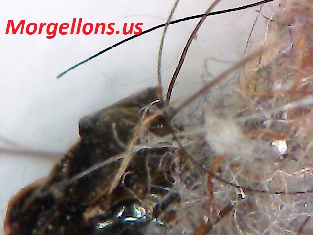 Aspergillus Fumigatus is the real pandemic - On your head and body Morgellons.us
