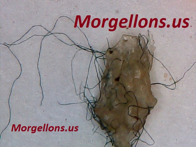Aspergillus Fumigatus moving - Morgellons Disease the silent Pandemic