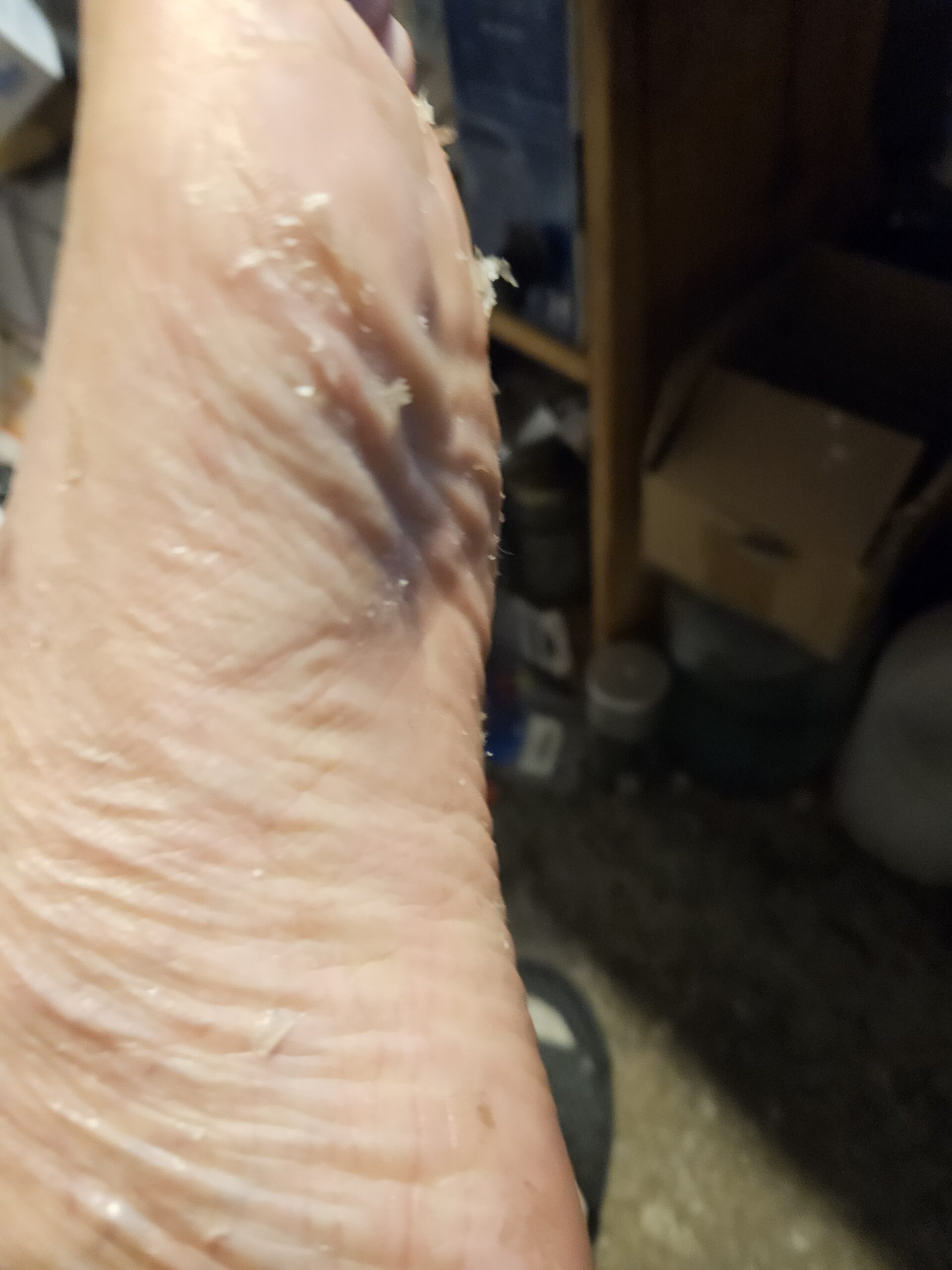 What to Expect Near the End! – Morgellons Desease The silent pandemic – Aspergillus Fumigatus